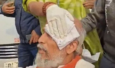 Parliament में गिरकर चोटिल हुए सांसद प्रताप सारंगी, बोले- राहुल गांधी ने दिया धक्का