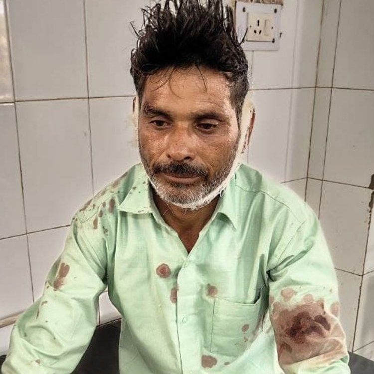 शिवपुरी में बस स्टाफ ने युवक को पीटा:हॉकी स्टिक से सिर फोड़ा, सीसीटीवी कैमरे की जांच कर कार्रवाई की मांग