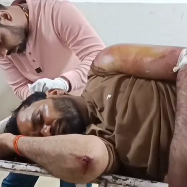 12 लोगों ने रॉड-डंडा और पाइप से पीटा, युवक बेहोश:बोलने की स्थिति में नहीं, गंभीर हालत में अस्पताल में भर्ती; भाई ने की शिकायत