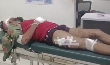 देवास में दो कारों की टक्कर, 6 घायल:एक इंदौर रेफर, गोदभराई से लौट रहा था परिवार; डेरिया बलड़ी के पास हादसा