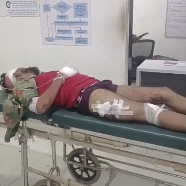 देवास में दो कारों की टक्कर, 6 घायल:एक इंदौर रेफर, गोदभराई से लौट रहा था परिवार; डेरिया बलड़ी के पास हादसा